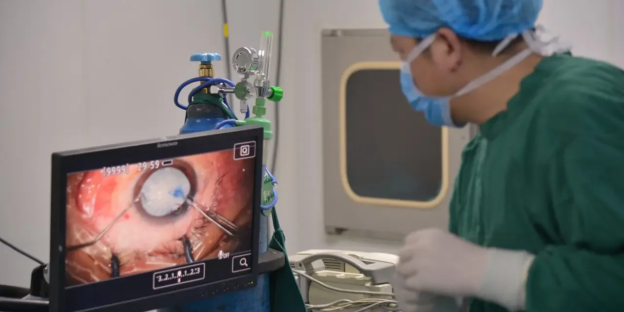 Cataract Surgery Procedure