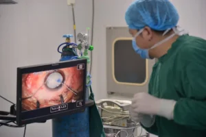 Cataract Surgery Procedure