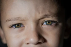 Vision Problems in Children