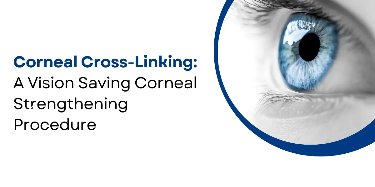 Corneal Cross-Linking for Keratoconus