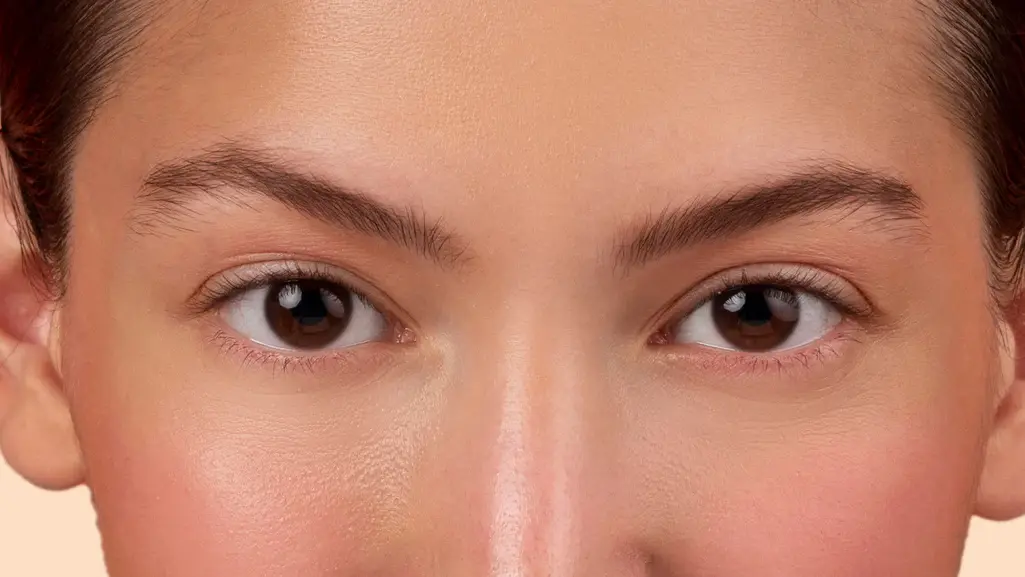 Post-operative care for squint surgery