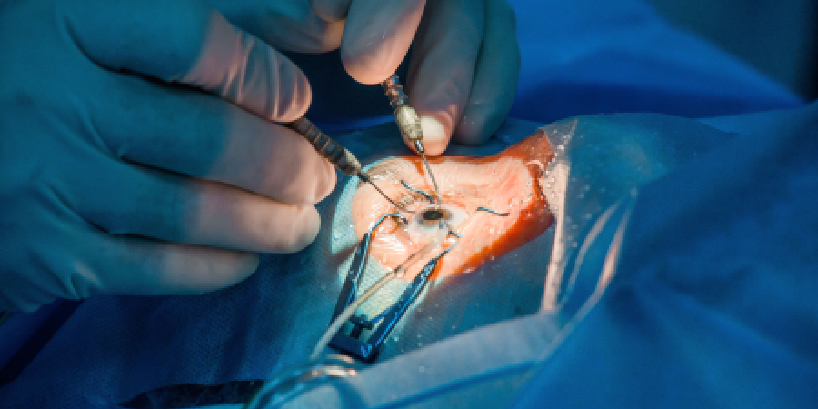 Eye Transplant Surgery