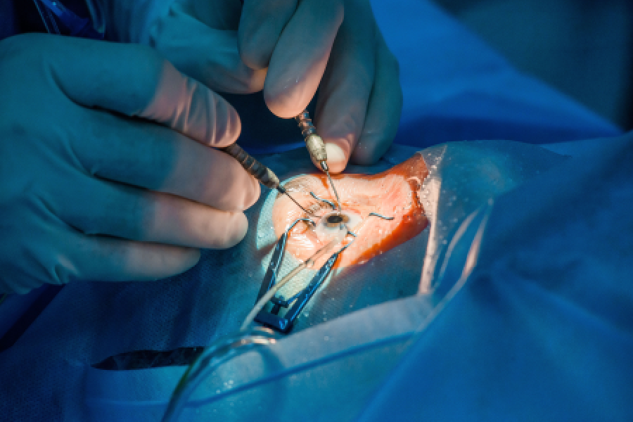 Eye Transplant Surgery
